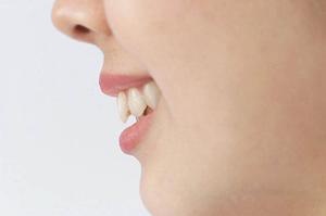 脂肪吸引の最新技術と安心クリニック選びのポイント